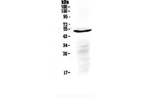 Western blot analysis of IL6R using anti-IL6R antibody . (IL-6 Receptor antibody  (C-Term))