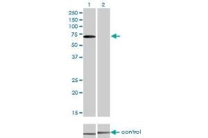 Western blot analysis of CARF over-expressed 293 cell line, cotransfected with CARF Validated Chimera RNAi (Lane 2) or non-transfected control (Lane 1). (CDKN2AIP antibody  (AA 1-579))