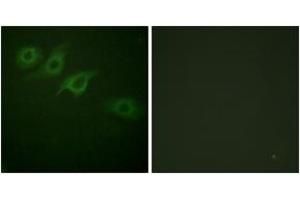 Immunofluorescence analysis of HepG2 cells, using Interferon-gamma Receptor alpha chain (Ab-457) Antibody. (IFNGR1 antibody  (AA 431-480))