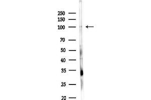 anti-Chondroitin Sulfate Synthase 3 (CHSY3) (N-Term) antibody