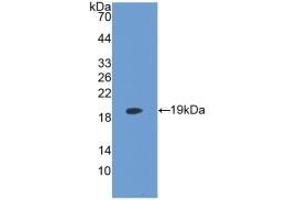 Detection of Recombinant LPCAT3, Human using Monoclonal Antibody to Lysophosphatidylcholine Acyltransferase 3 (LPCAT3) (LPCAT3 antibody  (AA 122-233))