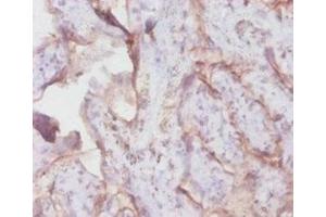 Immunohistochemistry of paraffin-embedded human placenta tissue using ABIN7172795 at dilution of 1:100 (Transferrin Receptor antibody  (AA 94-754))