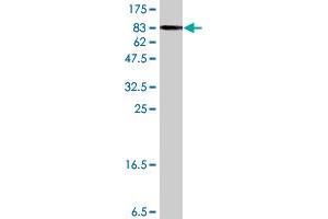 Western Blot detection against Immunogen (91. (PDLIM5 antibody  (AA 1-596))