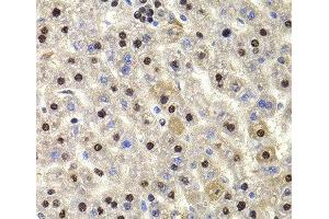 Immunohistochemistry of paraffin-embedded Rat liver using HIRIP3 Polyclonal Antibody at dilution of 1:100 (40x lens). (HIRIP3 antibody)