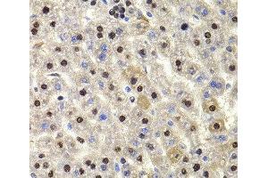 Immunohistochemistry of paraffin-embedded Rat liver using HIRIP3 Polyclonal Antibody at dilution of 1:100 (40x lens).