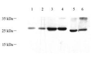 Western blot analysis of HOXD12 (ABIN7074252) at dilution of 1: 500 (HOXD12 antibody)