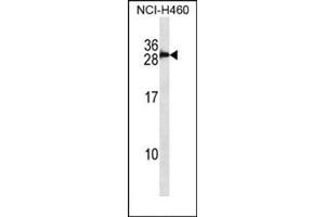 Western blot analysis in NCI-H460 cell line lysates (35 ug/lane) using S100B Antibody (Center) Cat.