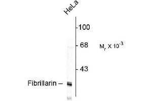 Western Blotting (WB) image for anti-Fibrillarin (FBL) antibody (ABIN371824) (Fibrillarin antibody)