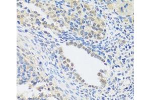 Immunohistochemistry of paraffin-embedded Rat ovary using C12orf10 Polyclonal Antibody at dilution of 1:100 (40x lens). (C12orf10 antibody)