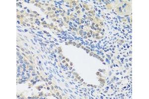 Immunohistochemistry of paraffin-embedded Rat ovary using C12orf10 Polyclonal Antibody at dilution of 1:100 (40x lens).