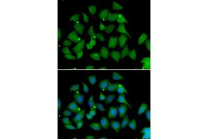 Immunofluorescence analysis of HeLa cell using FMO1 antibody. (FMO1 antibody)