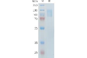 SDS-PAGE (SDS) image for phospholipase A2 Receptor 1, 180kDa (PLA2R1) (AA 1097-1246), (AA 21-521) protein (His tag) (ABIN7538473)