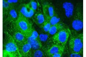 IF analysis of Beta 2 Microglobulin using anti- Beta 2 Microglobulin antibody (ABIN5518810). (beta-2 Microglobulin antibody  (AA 22-119))