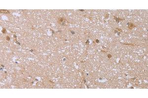 Immunohistochemistry of paraffin-embedded Human brain using FHL2 Polyclonal Antibody at dilution of 1:40 (FHL2 antibody)