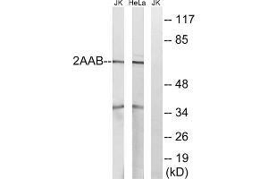 Western blot analysis of extracts from Jurkat cells and HeLa cells, using PPP2R1B antibody. (PPP2R1B antibody  (C-Term))