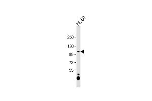 Anti-C12orf30 Antibody (Center) at 1:1000 dilution + HL-60 whole cell lysate Lysates/proteins at 20 μg per lane. (NAA25 antibody  (AA 720-748))