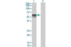 Western Blot analysis of IRX6 expression in transfected 293T cell line by IRX6 monoclonal antibody (M01), clone 1A5. (IRX6 antibody  (AA 337-446))