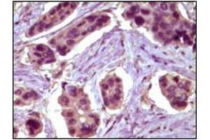 Immunohistochemistry (IHC) image for anti-B-Cell CLL/lymphoma 10 (BCL10) antibody (ABIN2464015) (BCL10 antibody)