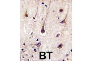 Formalin-fixed and paraffin-embedded human brain tissue reacted with PIK3R2 polyclonal antibody  , which was peroxidase-conjugated to the secondary antibody, followed by DAB staining. (PIK3R2 antibody)