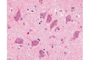 Immunohistochemical staining of human brain, neurons and glia (BAI2 antibody  (N-Term))