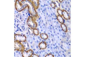 Immunohistochemistry (Paraffin-embedded Sections) (IHC (p)) image for anti-Myosin IC (MYO1C) (AA 769-1028) antibody (ABIN6144280)