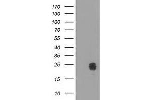HEK293T cells were transfected with the pCMV6-ENTRY control (Left lane) or pCMV6-ENTRY CLPP (Right lane) cDNA for 48 hrs and lysed. (CLPP antibody)
