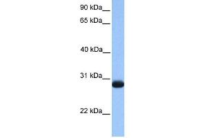 WB Suggested Anti-ZMAT3 Antibody Titration:  0. (ZMAT3 antibody  (N-Term))