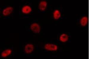 ABIN6275744 staining HepG2 by IF/ICC. (NPAS1 antibody  (Internal Region))