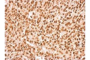 IHC-P Image APE1 antibody [N1], N-term detects APEX1 protein at nucleus on Saos2 xenograft by immunohistochemical analysis.