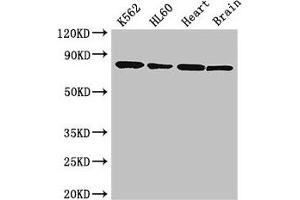 Western Blot Positive WB detected in: K562 whole cell lysate, HL60 whole cell lysate, Mouse heart tissue, Mouse brain tissue All lanes: BTK antibody at 3. (BTK antibody  (AA 254-443))