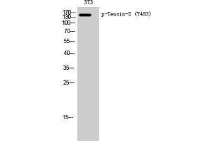Western Blotting (WB) image for anti-Tensin Like C1 Domain Containing Phosphatase (Tensin 2) (TENC1) (pTyr483) antibody (ABIN3172982) (TENC1 antibody  (pTyr483))