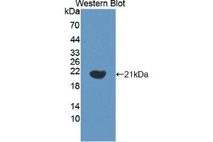 Figure. (HLTF antibody  (AA 831-990))