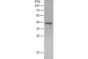 Western Blotting (WB) image for Prothymosin, alpha (PTMA) (AA 1-111) protein (His-IF2DI Tag) (ABIN7124695) (PTMA Protein (AA 1-111) (His-IF2DI Tag))