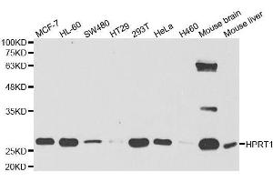 Western blot analysis of extracts of various cell lines, using HPRT1 antibody. (HPRT1 antibody  (AA 1-218))