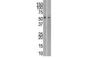 Image no. 1 for anti-RuvB-Like 2 (E. Coli) (RUVBL2) (C-Term) antibody (ABIN357238) (RUVBL2 antibody  (C-Term))