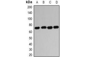 Western blot analysis of IGF2BP1 expression in HL60 (A), K562 (B), NIH3T3 (C), mouse liver (D) whole cell lysates.