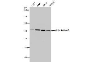 WB Image alpha Actinin 3 antibody detects alpha Actinin 3 protein by western blot analysis. (ACTN3 antibody  (Center))