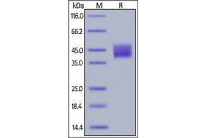 SDS-PAGE (SDS) image for Mesothelin (MSLN) (AA 296-580) (Active) protein (His tag) (ABIN6938912)