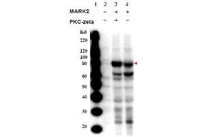 Image no. 1 for anti-MAP/microtubule Affinity-Regulating Kinase 2 (MARK2) (Isoform A), (pThr595) antibody (ABIN401318) (MARK2 antibody  (Isoform A, pThr595))