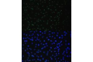 Immunofluorescence analysis of C6 cells using DDX50 antibody (ABIN6129371, ABIN6139509, ABIN6139510 and ABIN6224730) at dilution of 1:100.