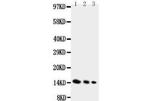 Anti-IL4 antibody, Western blotting Lane 1: Recombinant Mouse IL-4 Protein 10ng Lane 2: Recombinant Mouse IL-4 Protein 5ng Lane 3: Recombinant Mouse IL-4 Protein 2. (IL-4 antibody  (C-Term))