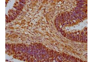 Immunohistochemistry (IHC) image for anti-14-3-3 zeta (YWHAZ) (AA 133-212) antibody (ABIN7142105)