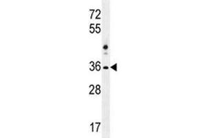 NKX1-2 antibody  (AA 1-2)