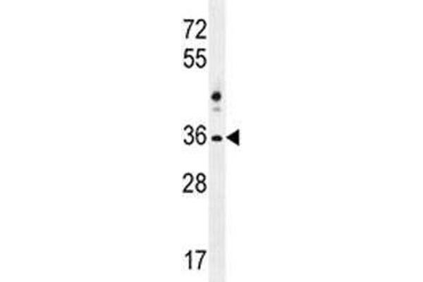 NKX1-2 antibody  (AA 1-2)