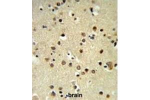 Immunohistochemistry (IHC) image for anti-Chromobox Homolog 1 (CBX1) antibody (ABIN3003963) (CBX1 antibody)
