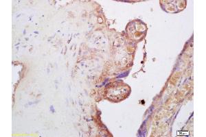 Formalin-fixed and paraffin embedded human placenta labeled with Anti-sLOX 1 Polyclonal Antibody, Unconjugated (ABIN705221) at 1:200 followed by conjugation to the secondary antibody and DAB staining (OLR1 antibody  (AA 201-273))