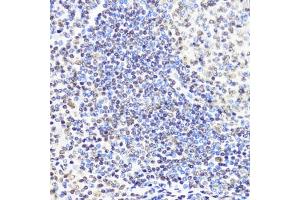 Immunohistochemistry of paraffin-embedded human tonsil using DNMT1 antibody (ABIN7266812) at dilution of 1:200 (40x lens). (DNMT1 antibody)