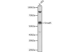 Western blot analysis of extracts of K-562 cells, using Smad5 antibody (ABIN7270354) at 1:1000 dilution. (SMAD5 antibody)