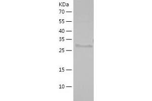 Western Blotting (WB) image for Zinc Finger Protein 161 Homolog (ZFP161) (AA 151-427) protein (His tag) (ABIN7284502) (ZBTB14/ZFP161 Protein (AA 151-427) (His tag))