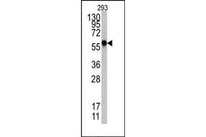 Image no. 1 for anti-Heat Shock Factor Protein 1 (HSF1) (Sumoylation Site) antibody (ABIN357730) (HSF1 antibody  (Sumoylation Site))
